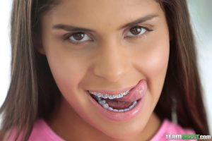 Brace Faced Katya Rodriguez in Have You Seen my Smile 2