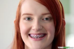 Brace Faced Krystal Orchid in Hefty Bracket Load 2